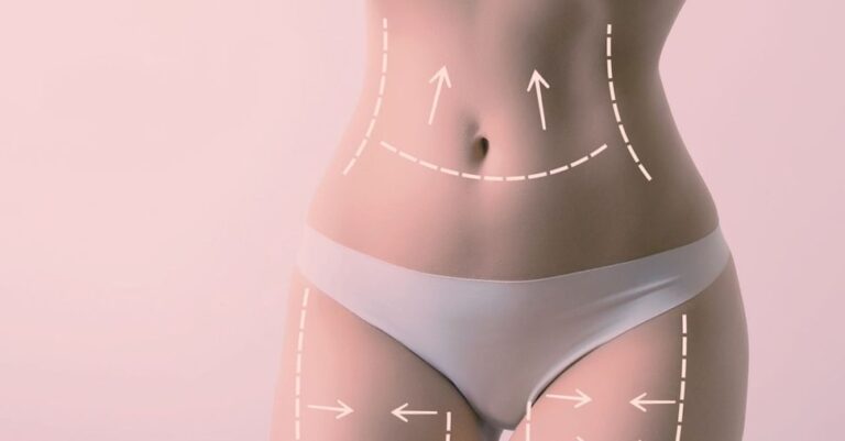 Liposuction, when the surgery becomes body sculpting
