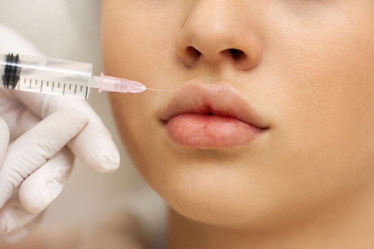 Teens are looking for help with botox and fillers. Experts