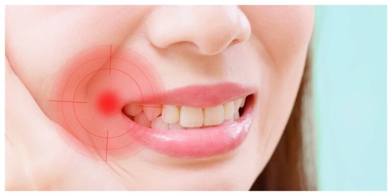 The importance of regular dental checkups for gum health