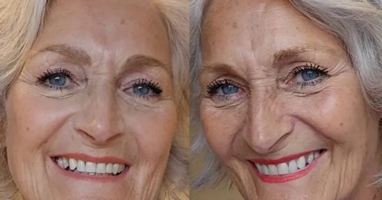 60 year old had 'no hope' for their yellow teeth until they