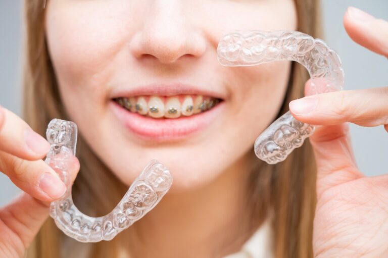 Clear aligners protect the oral microbiome better than fixed braces