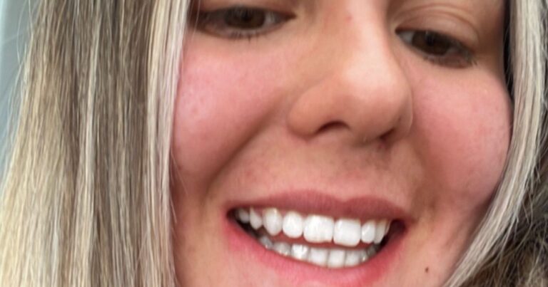 "I spent five years with braces for beautiful teeth
